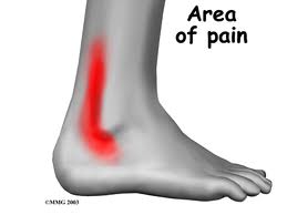 area of pain